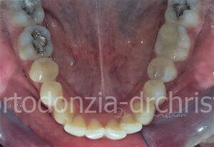 Allineatori_adulto-PRIMA