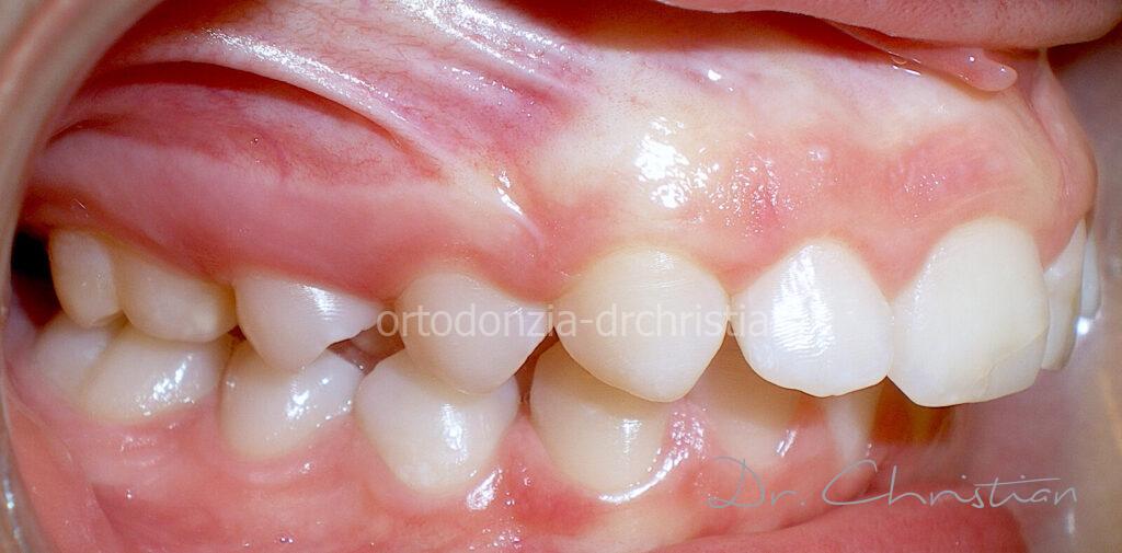 II_classe_adolescente-PRIMA