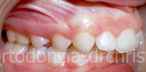 II_classe_adolescente-PRIMA