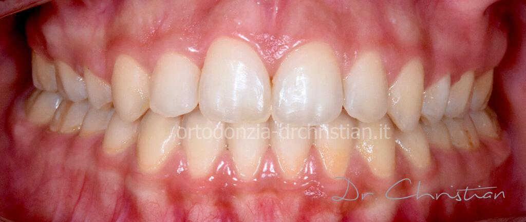 II_classe_adulto-DOPO