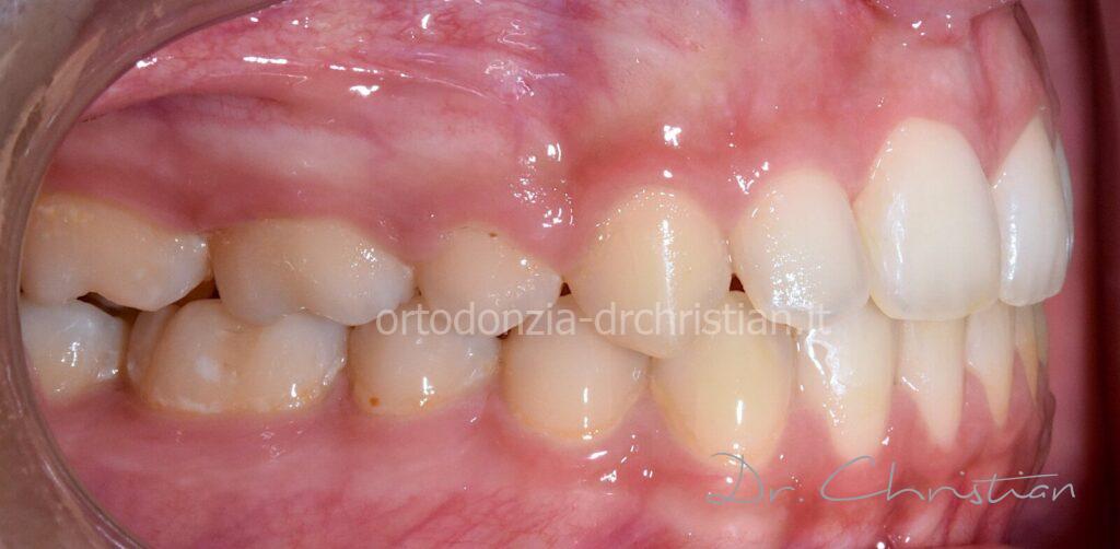 II_classe_adulto-DOPO