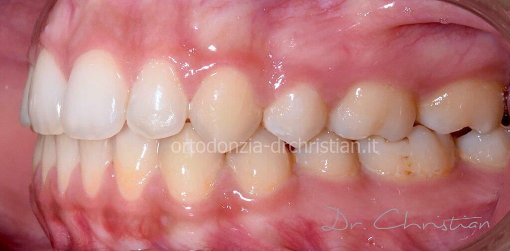 II_classe_adulto-DOPO