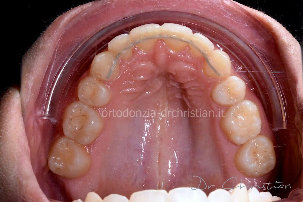 II_classe_adulto-DOPO