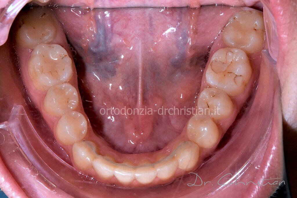 II_classe_adulto-DOPO